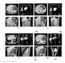 Fig. 01 - Method and system for segmenting a liver object in an image
