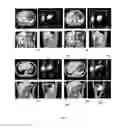 Fig. 05 - Method and system for segmenting a liver object in an image