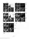 Fig. 06 - Method and system for segmenting a liver object in an image