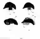 Fig. 08 - Method and system for segmenting a liver object in an image