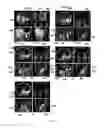 Fig. 09 - Method and system for segmenting a liver object in an image