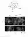 Fig. 13 - Method and system for segmenting a liver object in an image