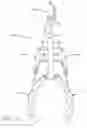 Fig. 06 - Rock grasping and removal apparatus