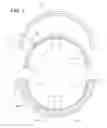 Fig. 03 - Turbine tip clearance measurement