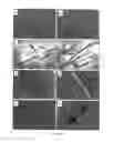 Fig. 06 - Use Of Adipose Tissue Cells For Initiating The Formation Of A Functional Vascular Network