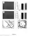 Fig. 07 - Use Of Adipose Tissue Cells For Initiating The Formation Of A Functional Vascular Network