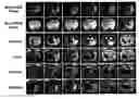 Fig. 01 - Compositions for improving migration potential of stem cells