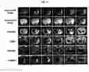 Fig. 02 - Compositions for improving migration potential of stem cells