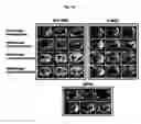 Fig. 03 - Compositions for improving migration potential of stem cells