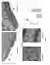 Fig. 08 - CD38 and obesity