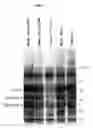 Fig. 04 - Insertion of foreign genes in rubella virus and their stable expression in a live, attenuated viral vaccine