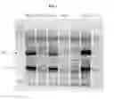 Fig. 08 - Insertion of foreign genes in rubella virus and their stable expression in a live, attenuated viral vaccine