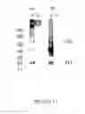 Fig. 13 - Functional influenza virus-like particles (VLPs)