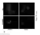 Fig. 29 - CATIONIC POLYMER COATED MESOPOROUS SILICA NANOPARTICLES AND USES THEREOF