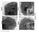 Fig. 65 - CATIONIC POLYMER COATED MESOPOROUS SILICA NANOPARTICLES AND USES THEREOF