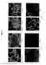 Fig. 08 - Pharmaceutical composition of nanoparticles