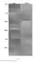 Fig. 07 - Amniotic membrane preparations and purified compositions and therapy for scar reversal and inhibition
