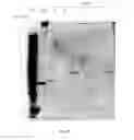 Fig. 16 - Amniotic membrane preparations and purified compositions and therapy for scar reversal and inhibition
