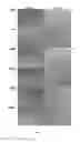Fig. 07 - Amniotic membrane preparations and purified compositions and anti-angiogenesis treatment