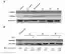 Fig. 01 - MSH3 Expression Status Determines the Responsiveness of Cancer Cells to the Chemotherapeutic Treatment with PARP Inhibitors and Platinum Drugs