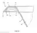 Fig. 09 - Container having a rim or other feature encapsulated by or formed from injection-molded material