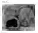 Fig. 33 - GLUTEN ADDITIVES FOR RICE BAKERY AND PREPARATION METHOD THEREOF
