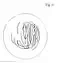 Fig. 07 - METHOD OF MANUFACTURING EYEGLASS LENS