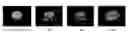 Fig. 01 - Dosage form exhibiting rapid disperse properties, methods of use and process for the manufacture of same