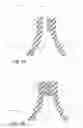 Fig. 06 - Peelable sealant containing thermoplastic composite blends for packaging applications