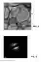 Fig. 04 - Procedure for obtaining graphene oxide nano-platelets and derivates and graphene oxide non-platelets thus obtained
