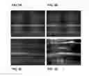 Fig. 06 - Methods for detecting pre-diabetes and diabetes using differential protein glycosylation