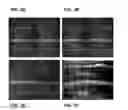 Fig. 06 - Methods for detecting pre-diabetes and diabetes using differential protein glycosylation