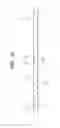 Fig. 15 - Semiconductor device and manufacturing method therefor