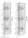 Fig. 08 - METHOD FOR FORMING A SELF-ALIGNED ISOLATION STRUCTURE UTILIZING SIDEWALL SPACERS AS AN ETCH MASK AND REMAINING AS A PORTION OF THE ISOLATION STRUCTURE