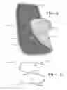 Fig. 08 - Drying mat