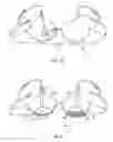 Fig. 03 - Brassiere with adjustable support