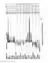Fig. 02 - METHODS AND COMPOSITIONS FOR DIAGNOSIS OF ACUTE MYOCARDIAL INFARCTION (AMI)