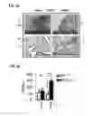 Fig. 05 - Method to Detect or Treat Painful Bladder Syndrome based on Relation to Quinone Oxidoreductase 1