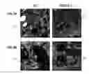 Fig. 09 - Method to Detect or Treat Painful Bladder Syndrome based on Relation to Quinone Oxidoreductase 1