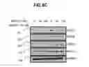 Fig. 12 - Method to Detect or Treat Painful Bladder Syndrome based on Relation to Quinone Oxidoreductase 1