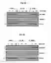 Fig. 13 - Method to Detect or Treat Painful Bladder Syndrome based on Relation to Quinone Oxidoreductase 1