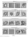 Fig. 06 - Method for inhibiting blood vessel stenosis