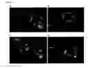 Fig. 08 - Class- and isoform-specific HDAC inhibitors and uses thereof