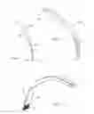 Fig. 04 - Retractor illumination system