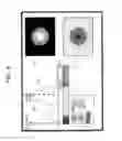 Fig. 09 - ULTRASONIC DIAGNOSTIC DEVICE, METHOD FOR GENERATING IMAGE FOR EVALUATING DISORDER OF PART TO BE DIAGNOSED OF OBJECT, AND PROGRAM FOR GENERATING IMAGE FOR EVALUATING DISORDER OF PART TO BE DIAGNOSED OF OBJECT