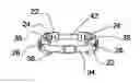 Fig. 01 - Method and apparatus for the nonsurgical correction of chest wall deformities