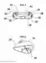 Fig. 02 - Method and apparatus for the nonsurgical correction of chest wall deformities
