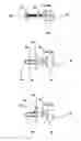 Fig. 04 - Method and apparatus for the nonsurgical correction of chest wall deformities