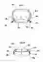 Fig. 06 - Method and apparatus for the nonsurgical correction of chest wall deformities