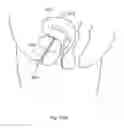 Fig. 320 - Robotic catheter system and methods